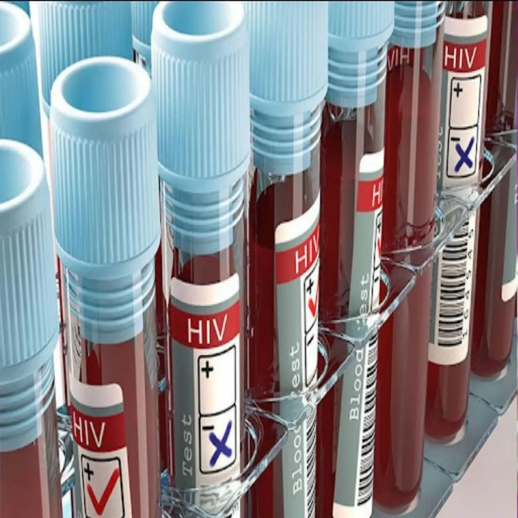 AIDS: Virological Appearance